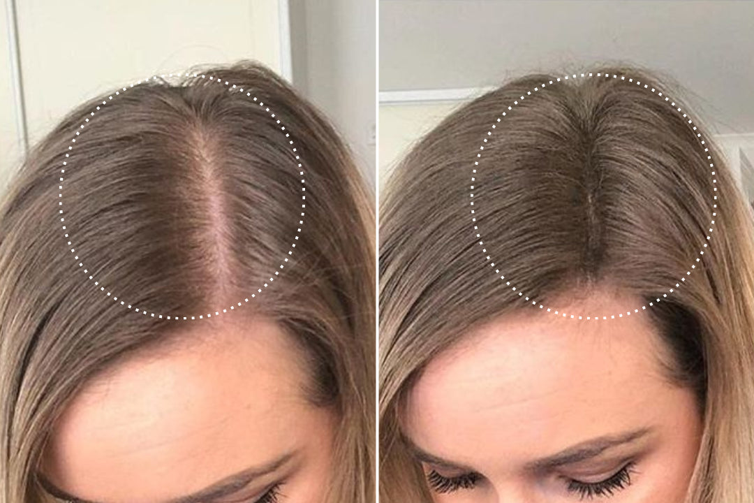 Elena, 44 before and after