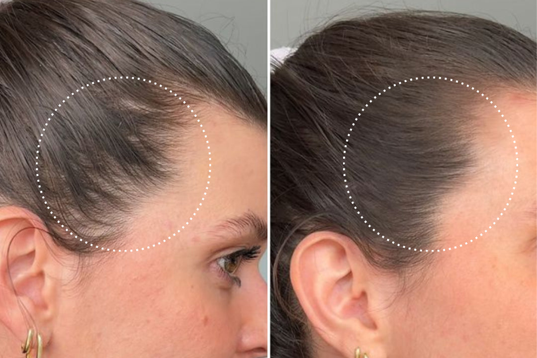 Isabel, 37 before and after