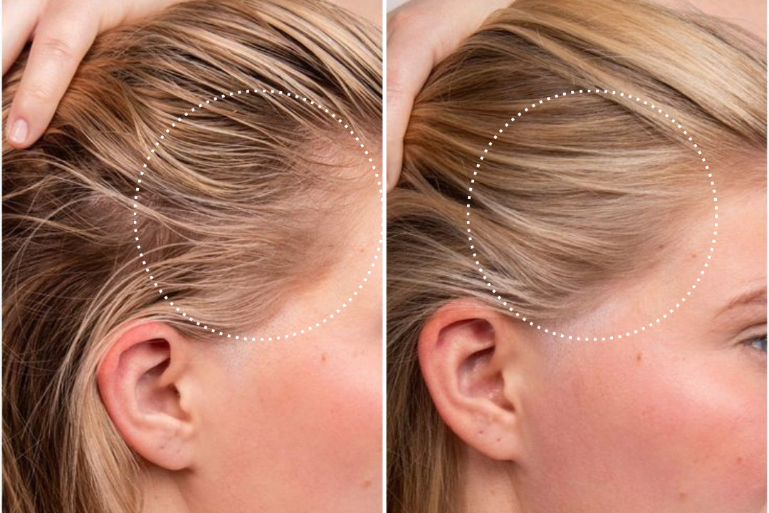 Diana, 34 before and after