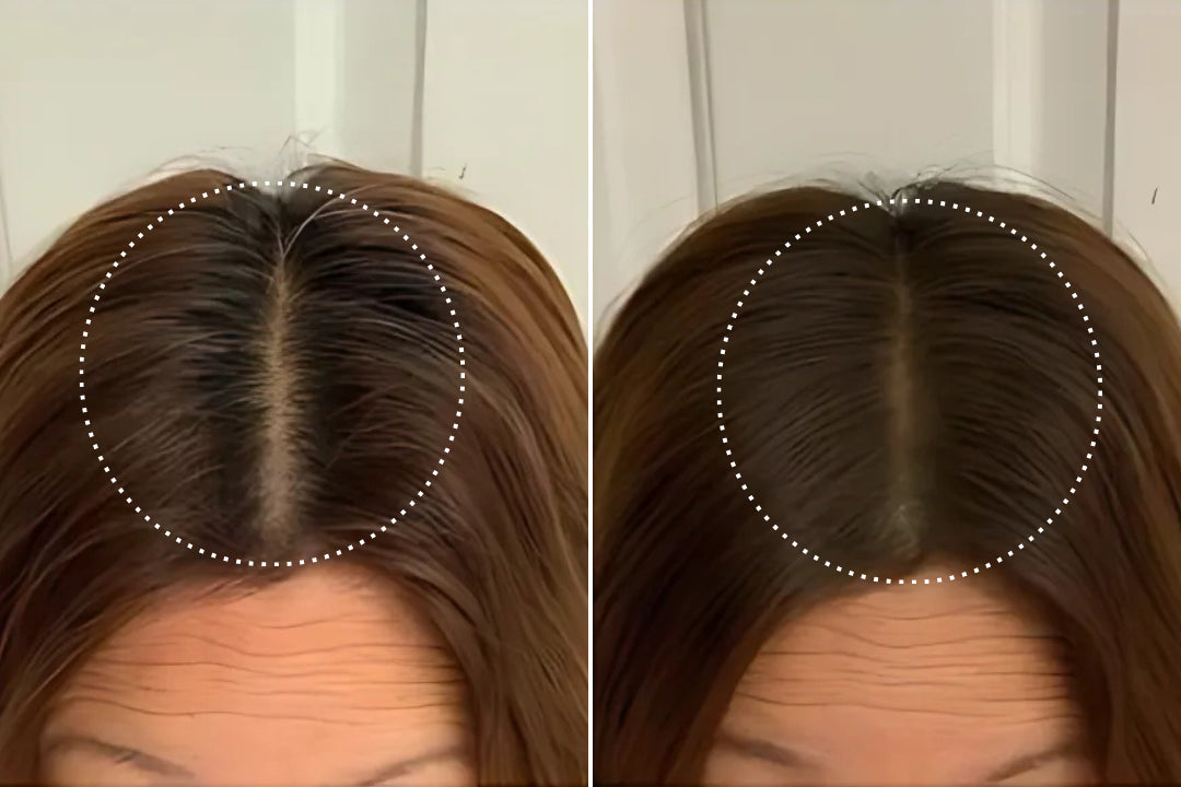 Rachel, 52 before and after