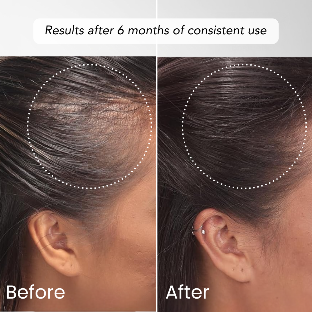 Hair Recovery Serum | Try it for 14 days
